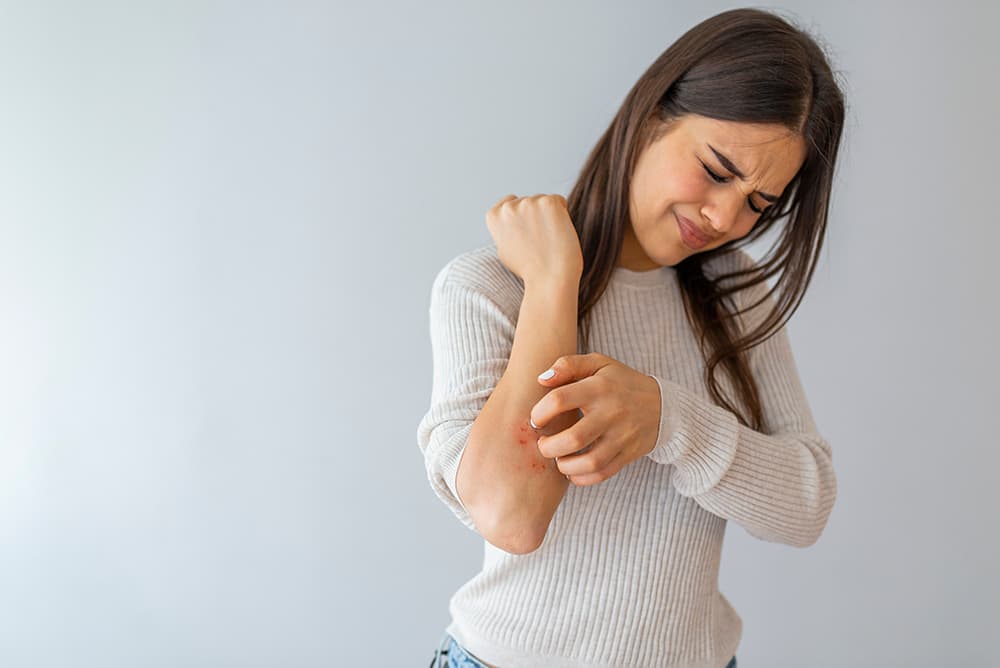 What to Track Before Consulting for Eczema